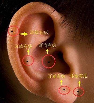 耳骨長痣|耳朵长痣的位置图解 耳朵长痣的位置图解有福气